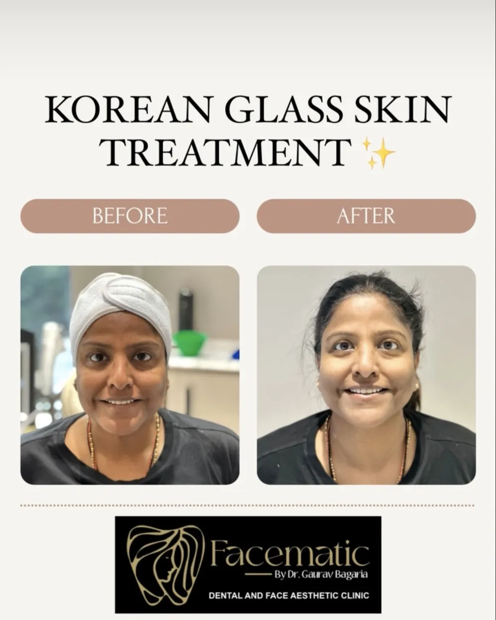 Korean glass skin, before and after at Facematic